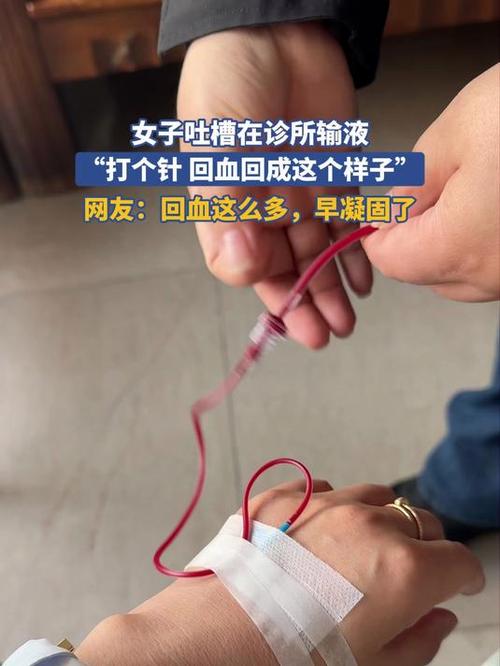 针式打印机越打越往上图标