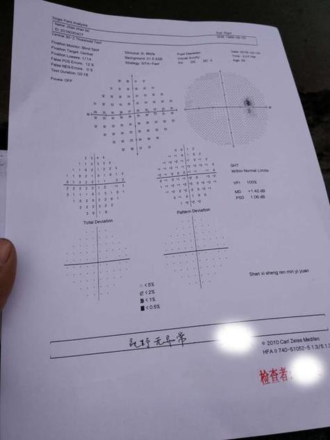正常视野是多少缩略图