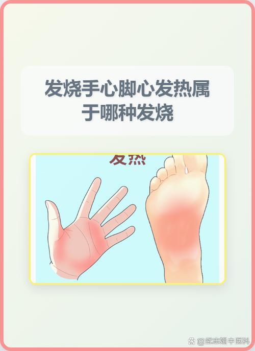 手掌很热是发烧吗截图