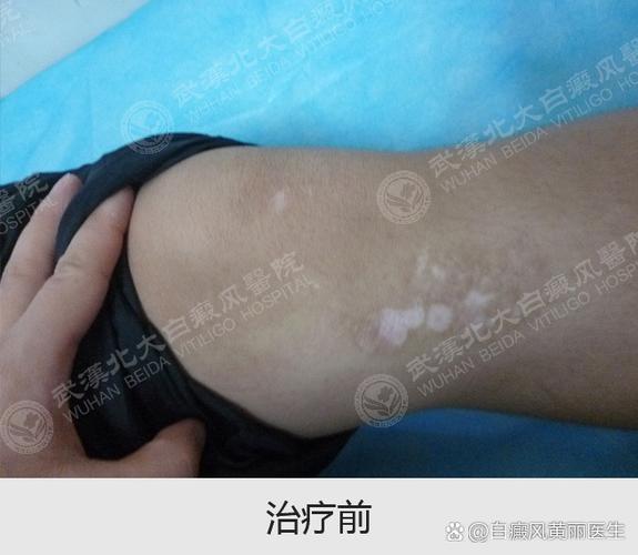手机左下角出现白块游戏截图