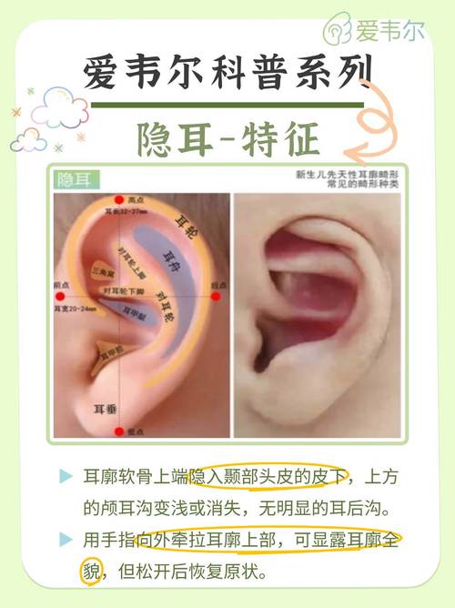 如何查找耳机定位