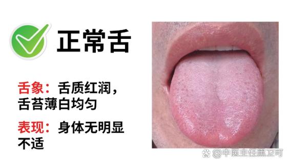 舌根起红泡是什么原因截图
