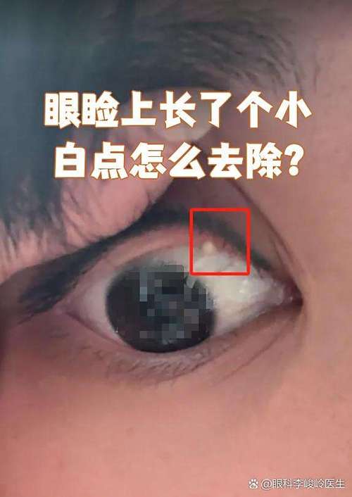 oppo手机屏幕白点怎么消除截图