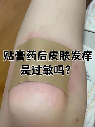 膏药沾到皮肤上怎么去掉截图