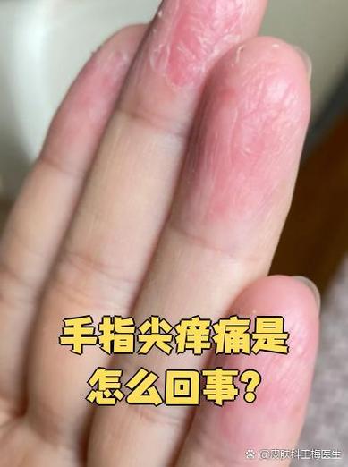 手机上挠痒痒游戏版截图