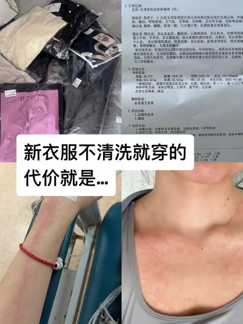 衣服洗变形了怎么恢复图标