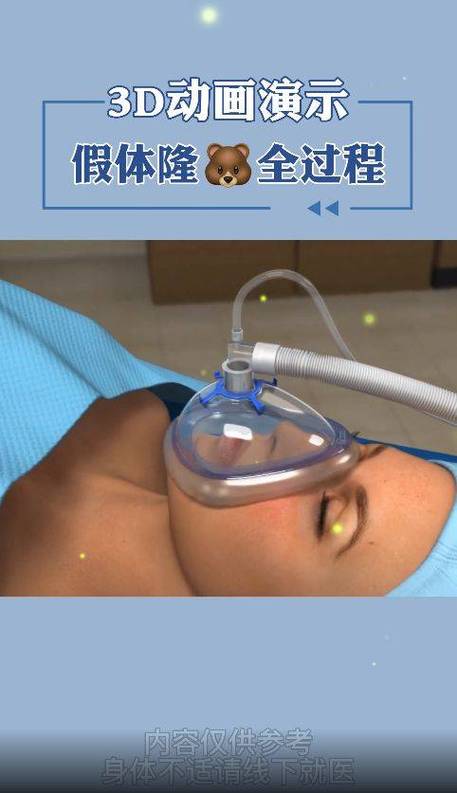 女生的胸长什么样子做手术视截图