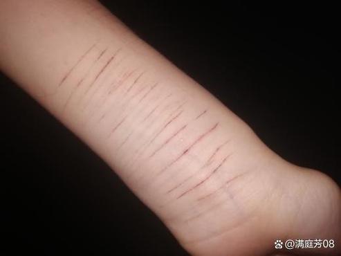 孩子划手腕属什么行为截图