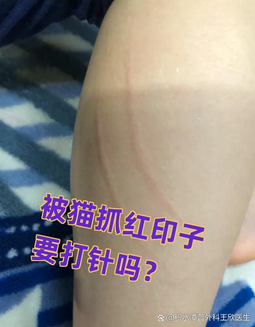 被猫抓了划痕找不到了截图