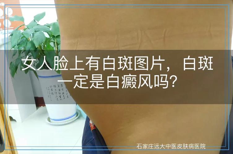 女性白斑是什么样子图片截图