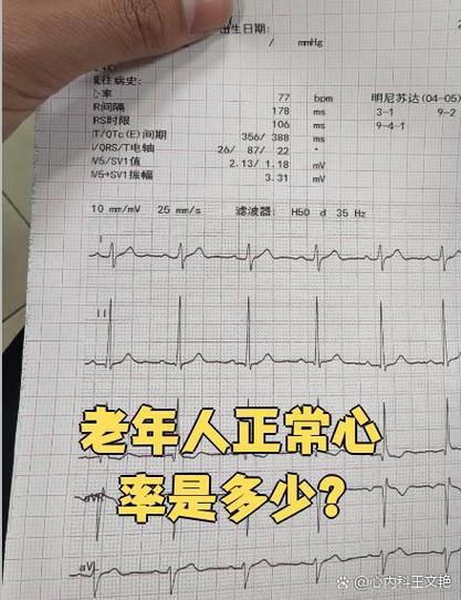 静息心率和静态心率是一回事吗游戏截图