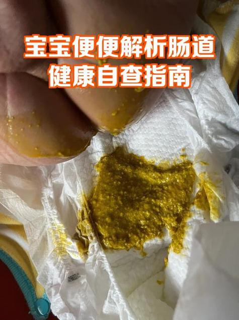 大便病毒感染怎么治疗图标