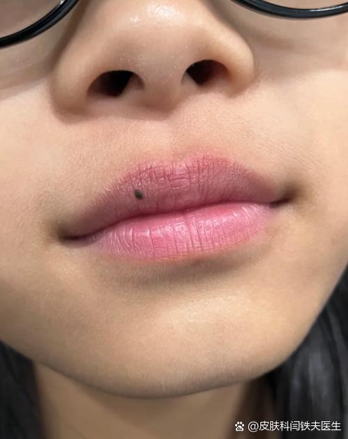 男生嘴唇粉红色正常吗截图