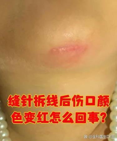 打印出来的照片发红怎么回事图标