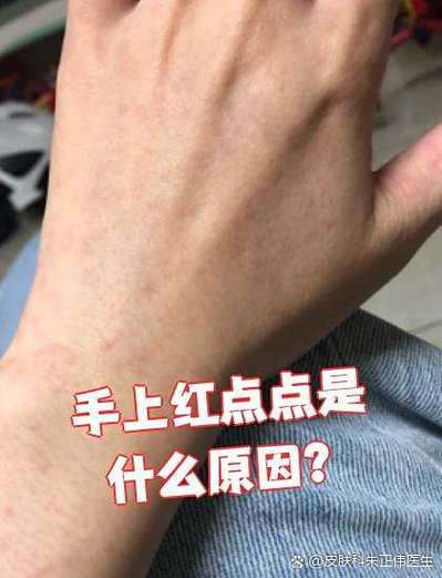 身上有红点是什么原因造成的