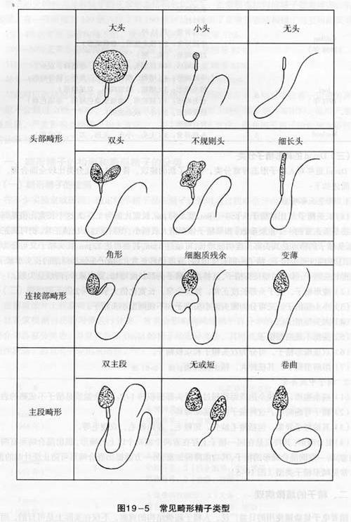 精子畸形率98虚惊一场图标