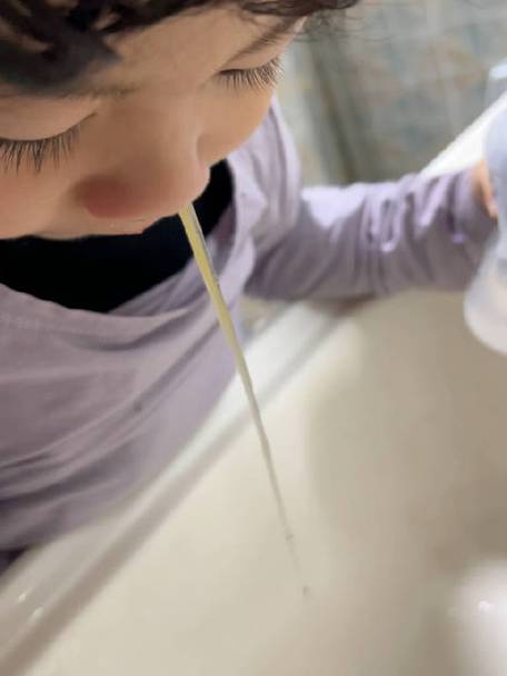 鼻涕视频图标