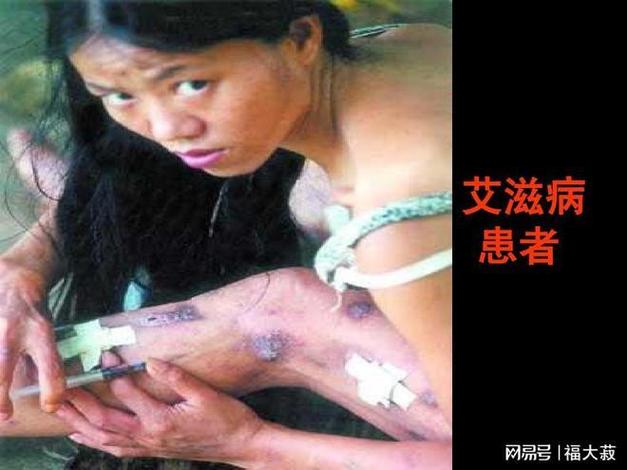 艾滋病感染者采访视频
