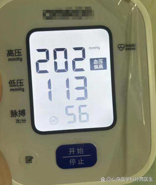 血压心率正常值是多少