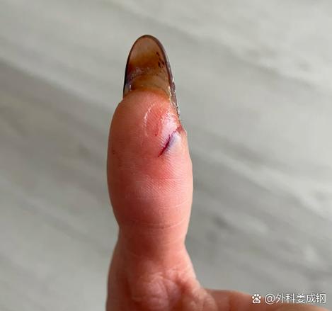 云南白药粉能撒在伤口上吗截图