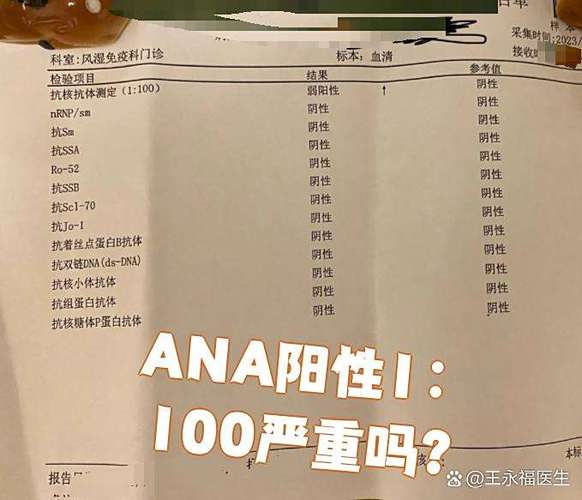 ana阴性好还是阳性好缩略图