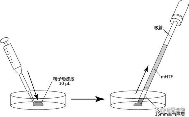 普通冷冻精子能存货活多久截图