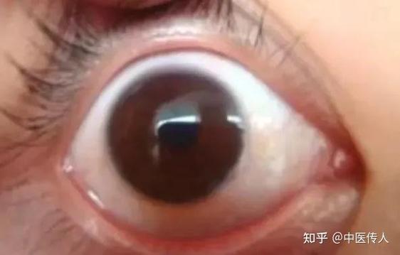 手机左上角出现黑色圆圈是什么原因