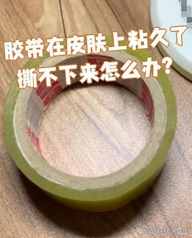 胶布粘上撕不下来怎么办缩略图