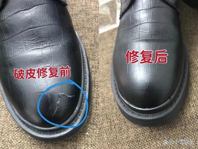鞋里掉皮怎么办小窍门图标