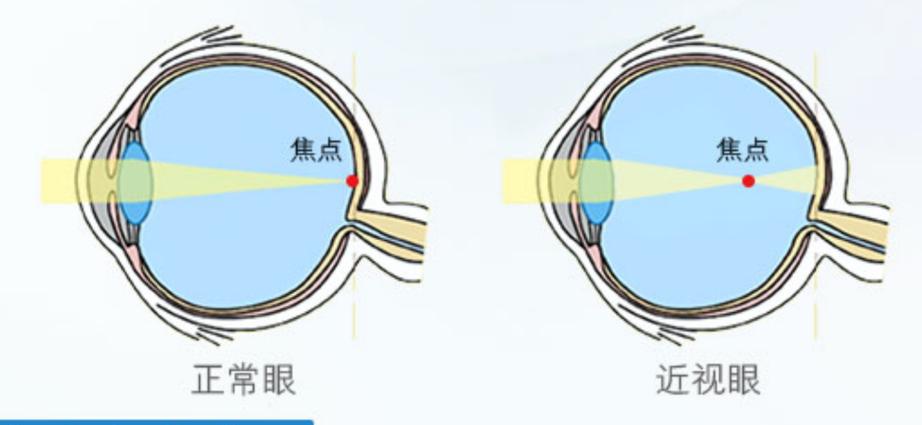 打开辅助功能截图