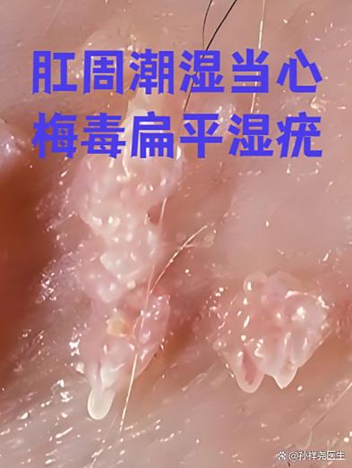 关于皮肤病的图片截图