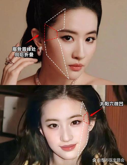 太阳穴填充用什么最好截图
