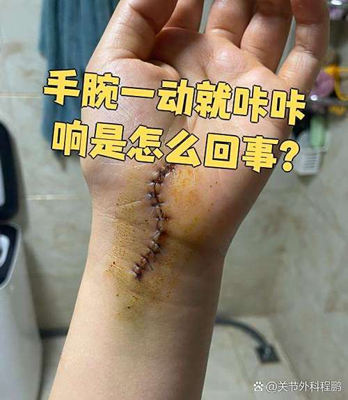 手腕关节响一动就响是什么原因