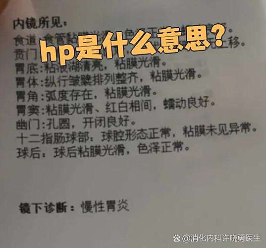 hp啥意思缩略图