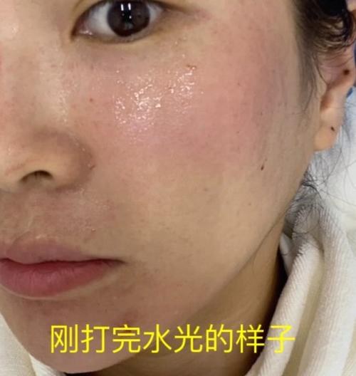 打了水光变黄截图