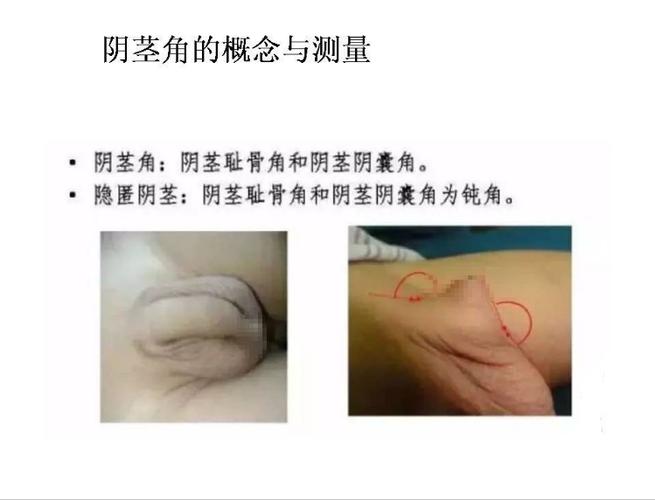 ip地址代理软件