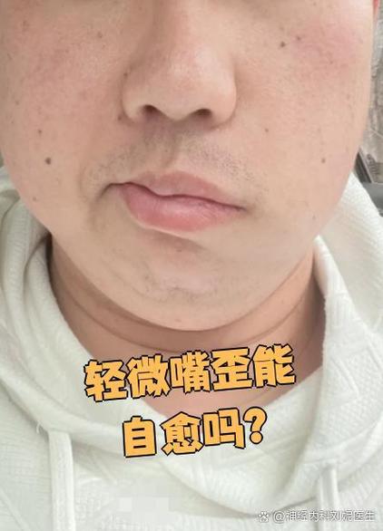 手机后置拍出来嘴巴是歪的截图