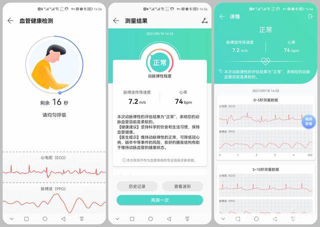 华为手环测出早搏是真早搏吗缩略图