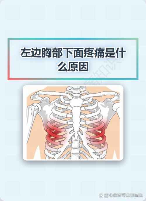 左侧腋窝下肋骨疼是怎么回事