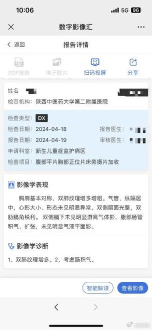 影像云胶片查询图标