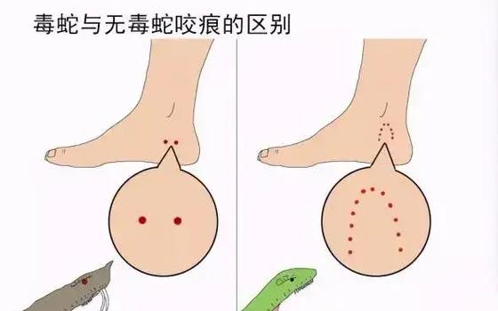 蟒蛇咬人疼吗缩略图