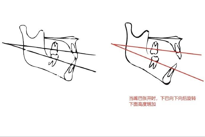 反向陀螺仪缩略图