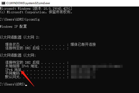 电视获取ip地址的几种原因