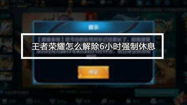 王者关系可以强制解除吗