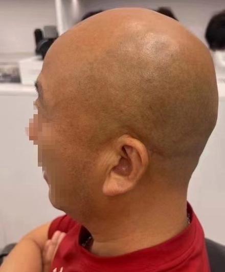 女主被强行剃光头的小说图标