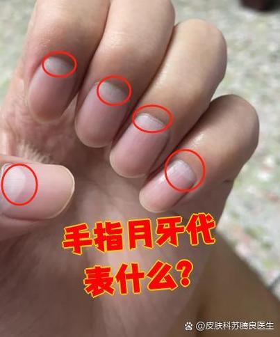 手机右上角出现月牙咋消缩略图
