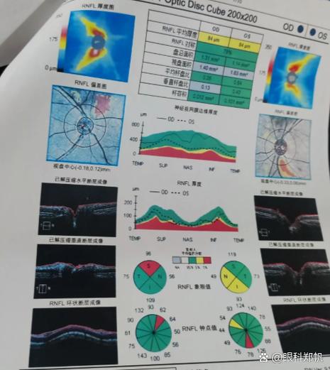 电视画面模糊和机顶盒有关系吗图标