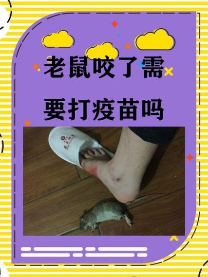被仓鼠咬了会得鼠疫吗