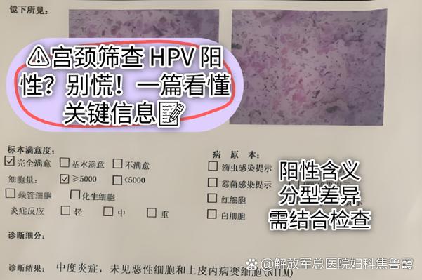 cd34阳性好还是阴性好