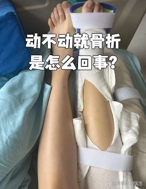不动不疼一动就疼是骨折吗